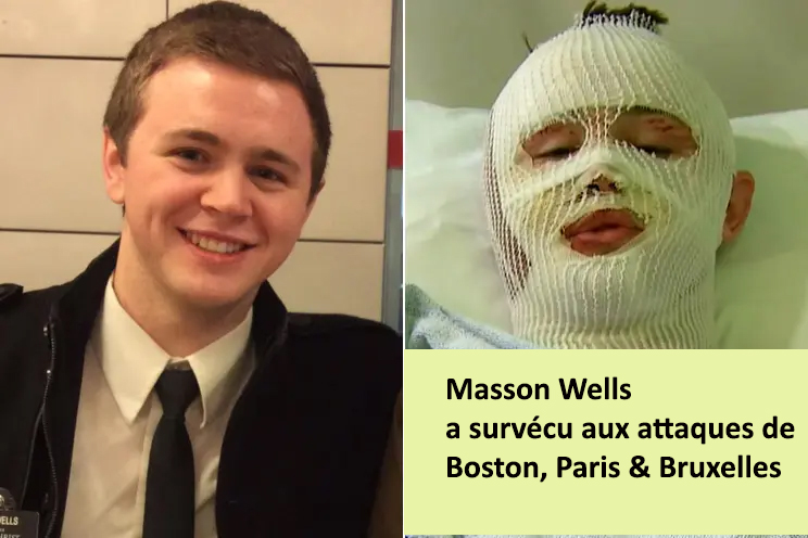 wells